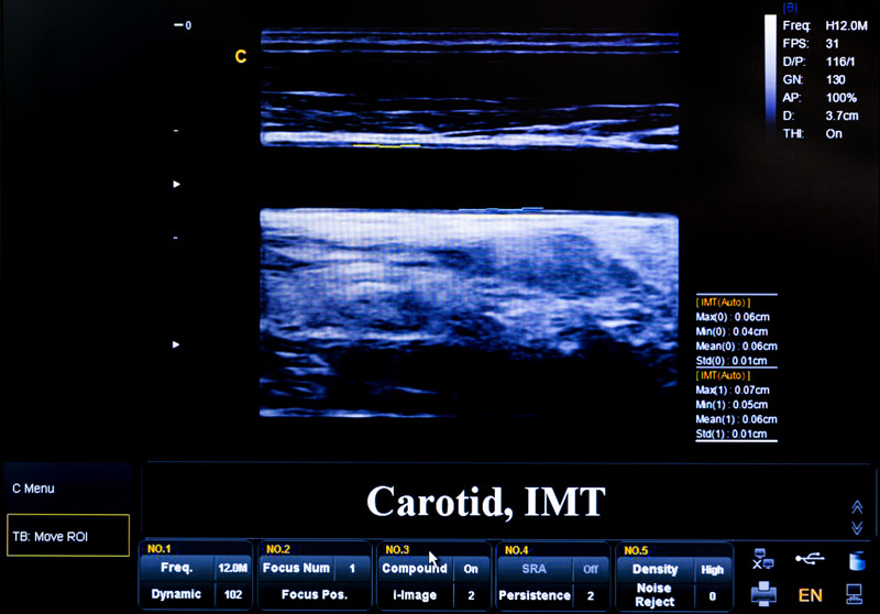 CIMT Test Reading