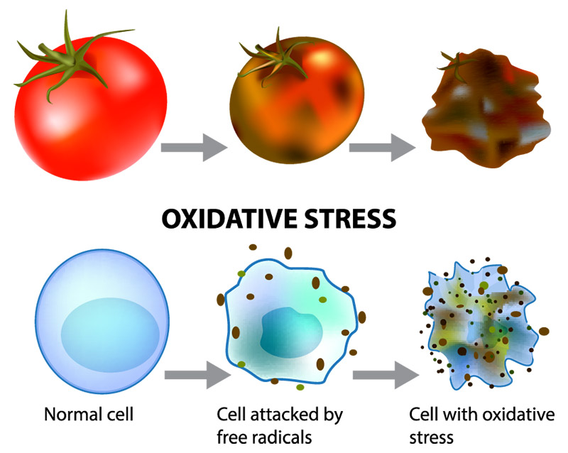 Oxidative Stress Infographic